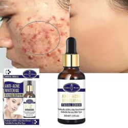 Serum anti-acné blanqueador