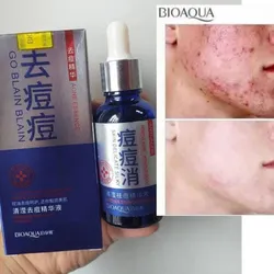 Serum antiacne de BIOAQUA 30ml