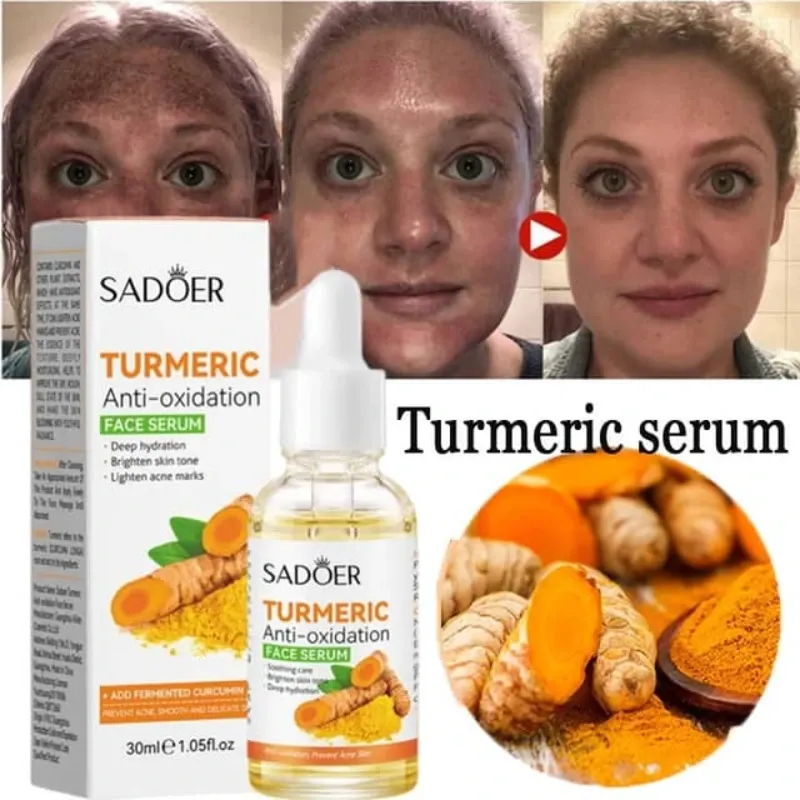 Sérum facial Aclarador de cúrcuma 30ml SADOER