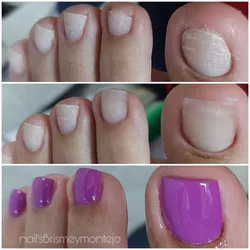 Gel de construcción 