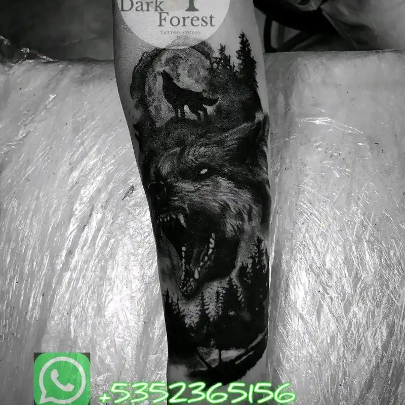 Antebrazo