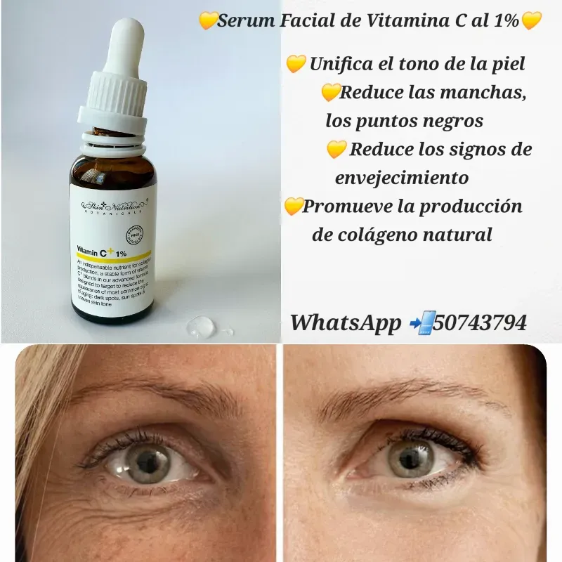 ☀️Serum Facial de Vitamina C al 1%☀️