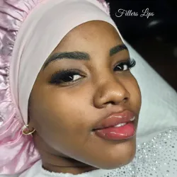 Aumento de labios