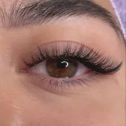 Efecto ojo de gato