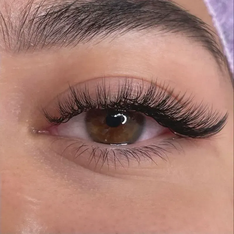Efecto ojo de gato
