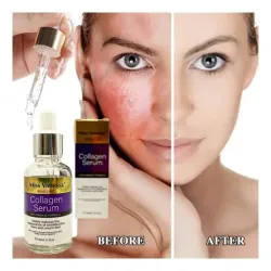 SERUM DE COLGENO 30ML