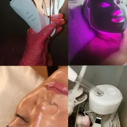 Limpieza Facial Profunda