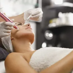 Dermapen Facial