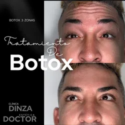 Tercio superior ( 3 zonas ) 🤩✨💉