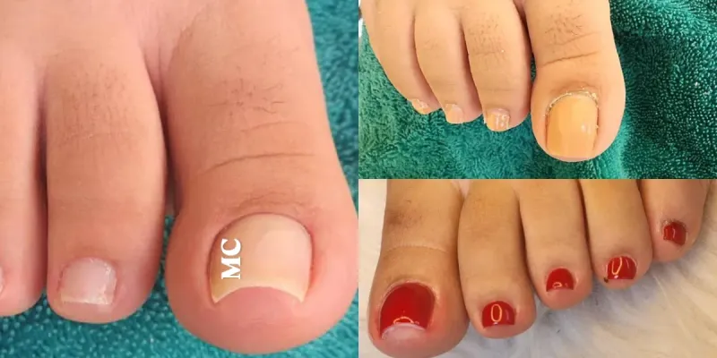 Pedicura 