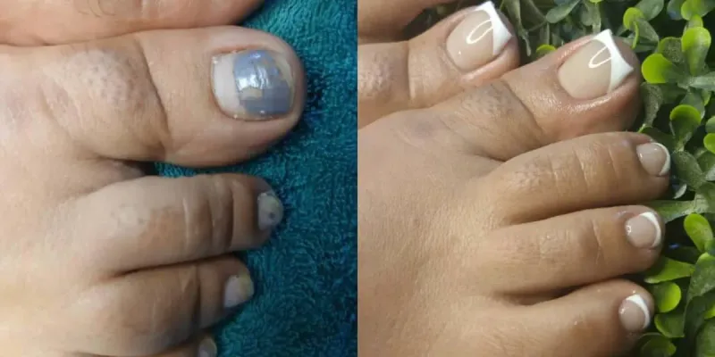 Pedicura 
