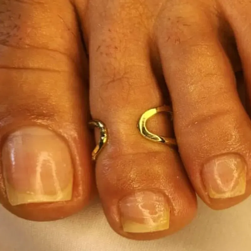 Pedicura 