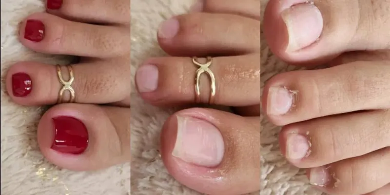 Pedicura 