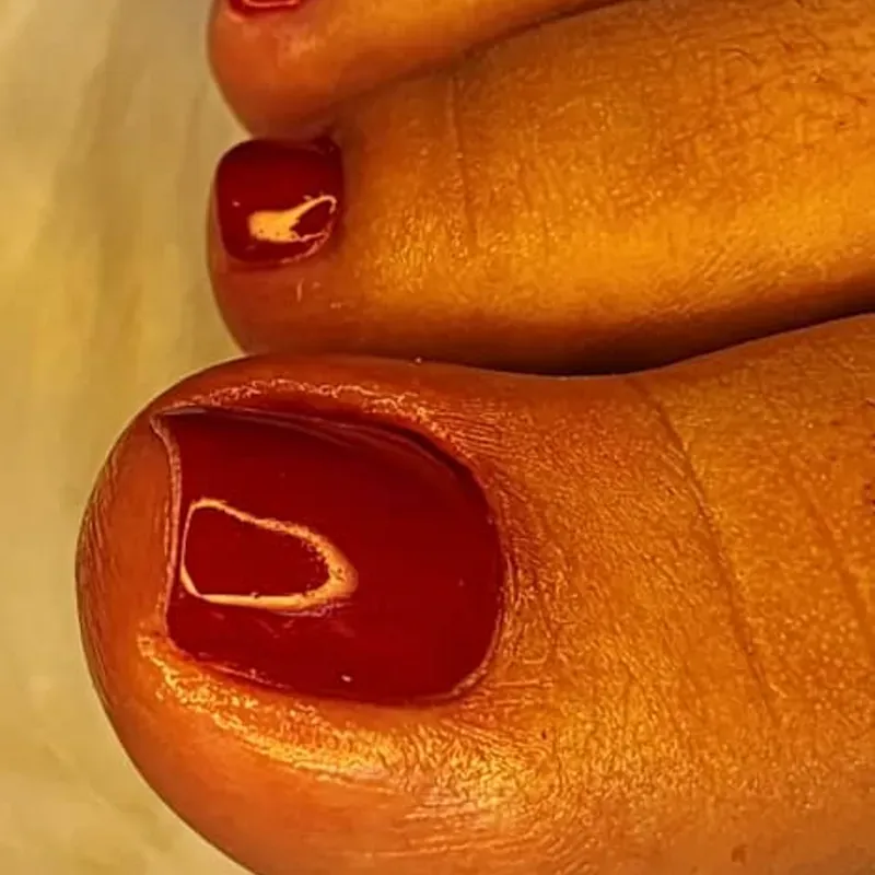 Pedicura 