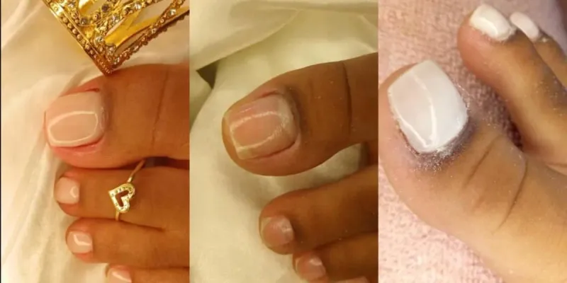 Pedicura 