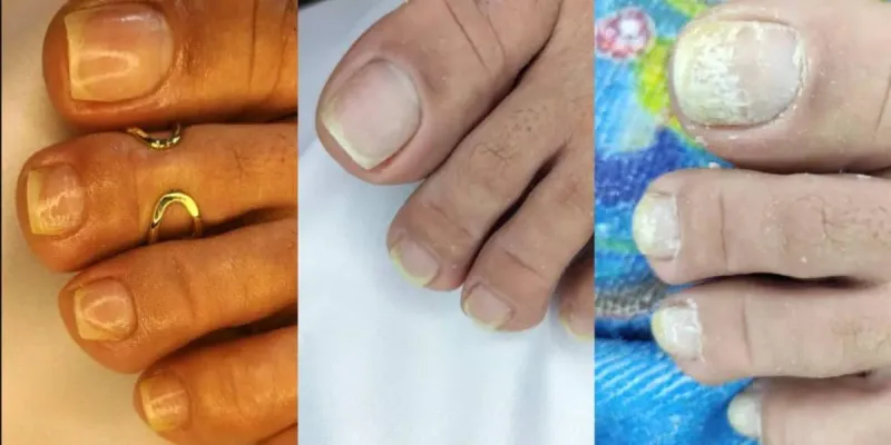 Pedicura 