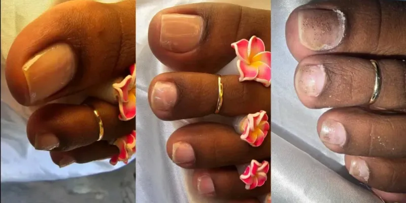 Pedicura 