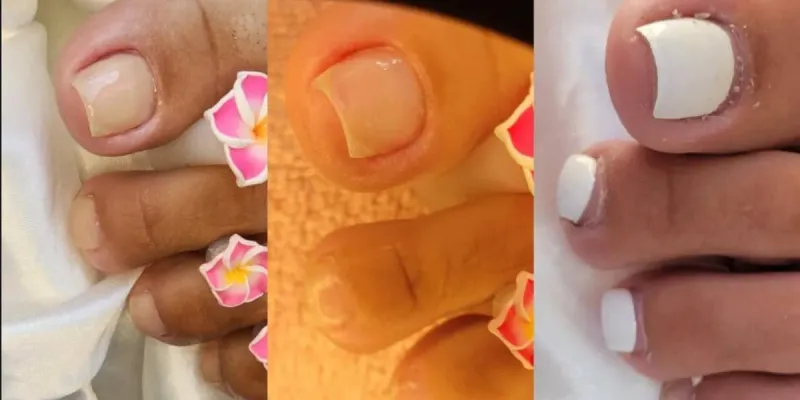 Pedicura 