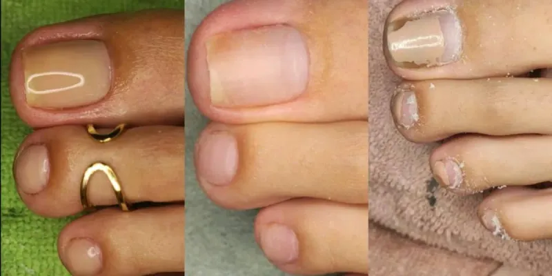 Pedicura 