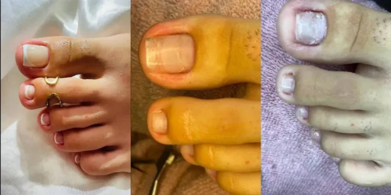 Pedicura 