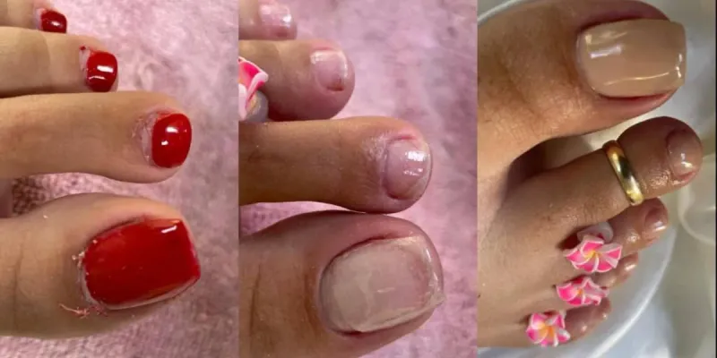Pedicura 