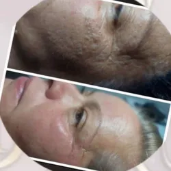 Higiene facial profunda