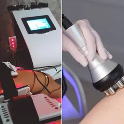 Lipoláser + radiofrecuencia ( incluye drenaje linfático)