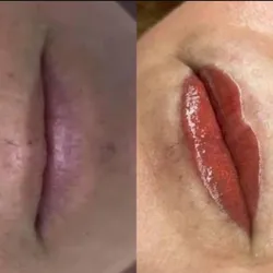 Micropigmentación
