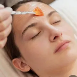 Peeling químico