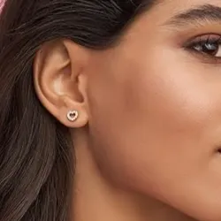 Aretes