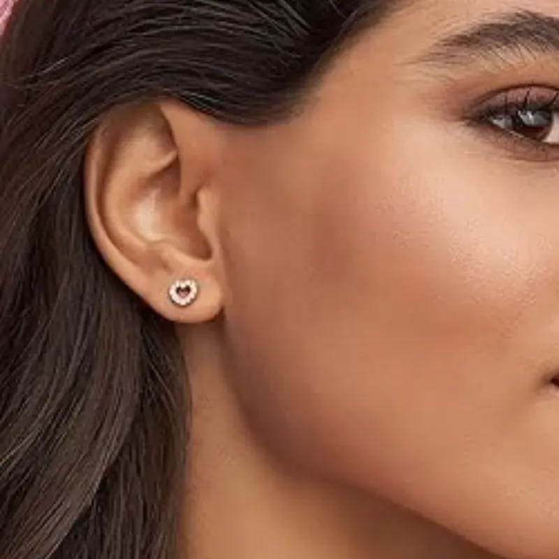 Aretes