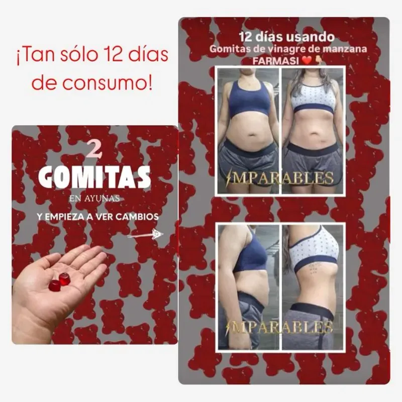 Gomitas de Cidra de Vinagre de Manzana (60 Gummies)