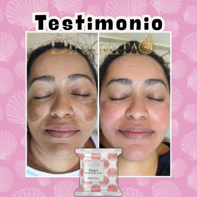 Jabón de Perlas 🫧 125g (Para eliminar manchas del rostro y el cuerpo)