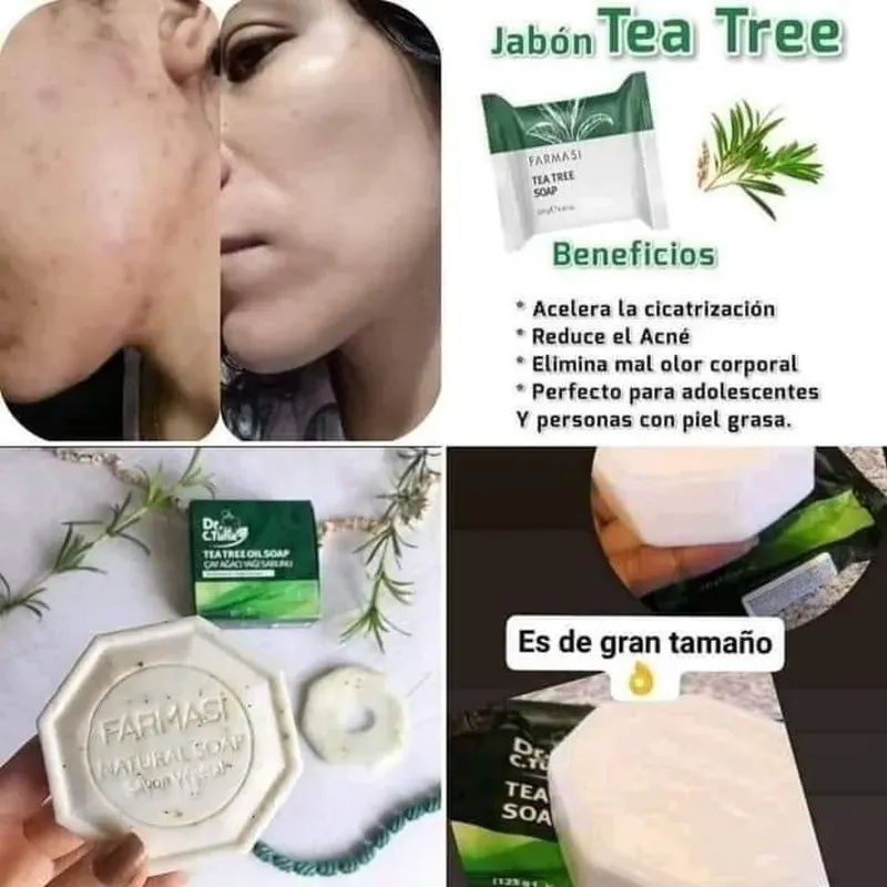 Jabón de Té Tree 125g (Para eliminar el acné)