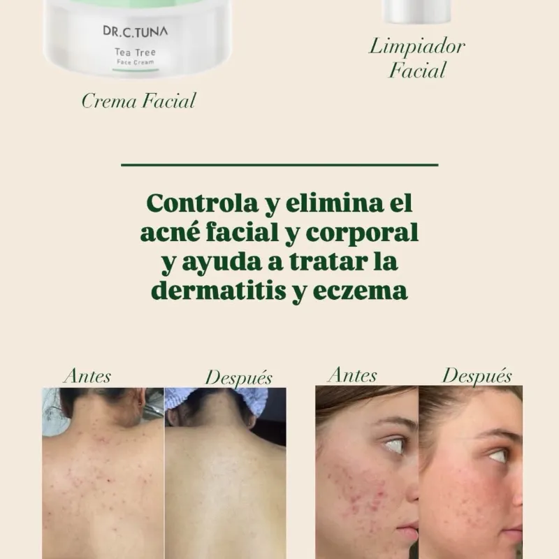 Bálsamo cremoso de árbol de té del Dr. C. Tuna