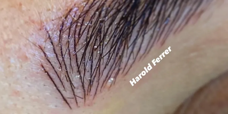 Microblading