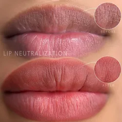 Neutralización de Labios