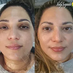 BB GLOW_Piel de porcelana