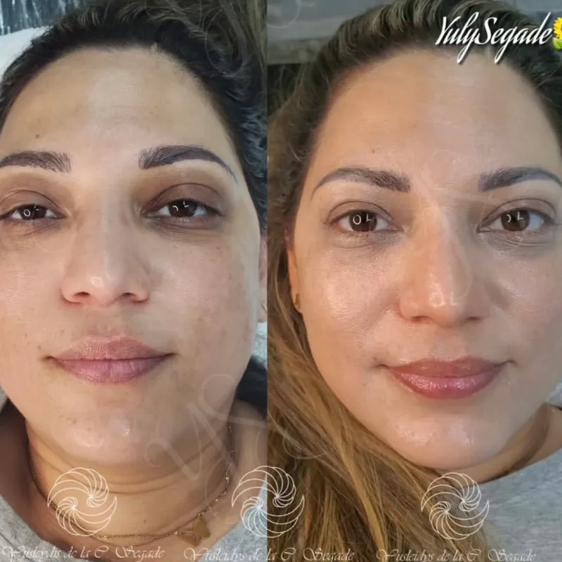 BB GLOW_Piel de porcelana