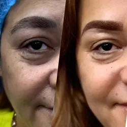 COVER UP_Corrección de cejas indeseadas