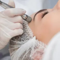 MICRODERMOABRASIÓN CON PUNTA DE DIAMANTES