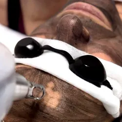 HOLLYWOOD PEEL  LASER