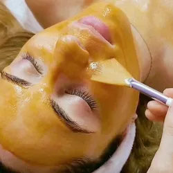 PEELING QUÍMICO FACIAL