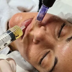 Plasma Rico en Plaqueta PRP O tratamiento Vampirico