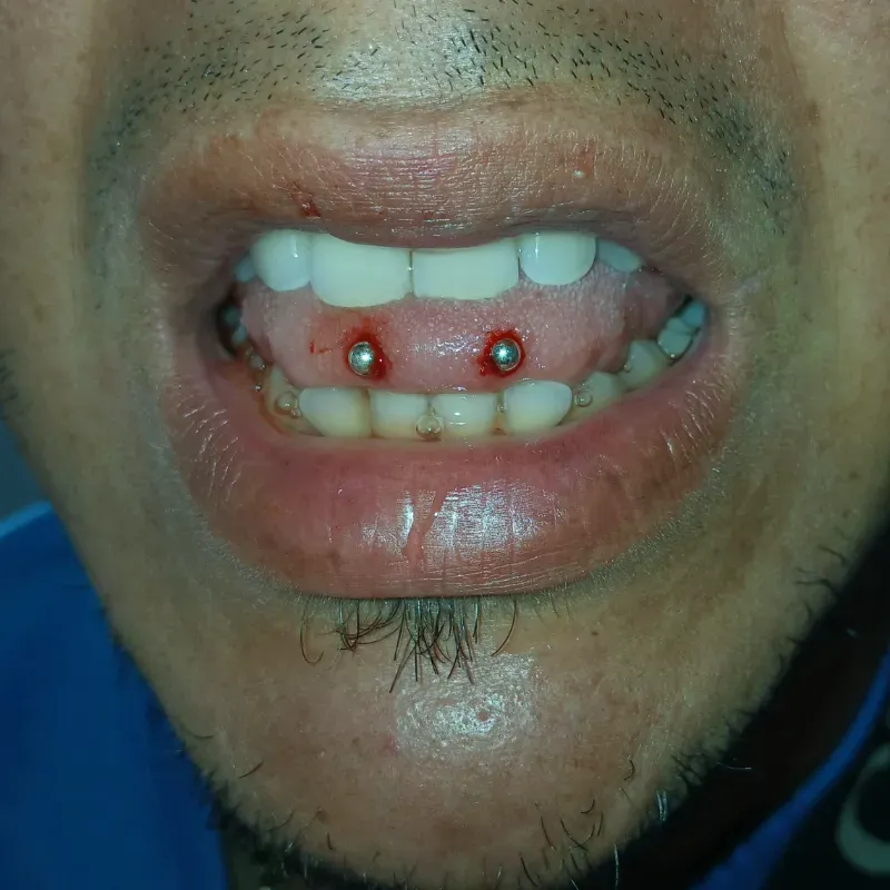 Snake Eyes