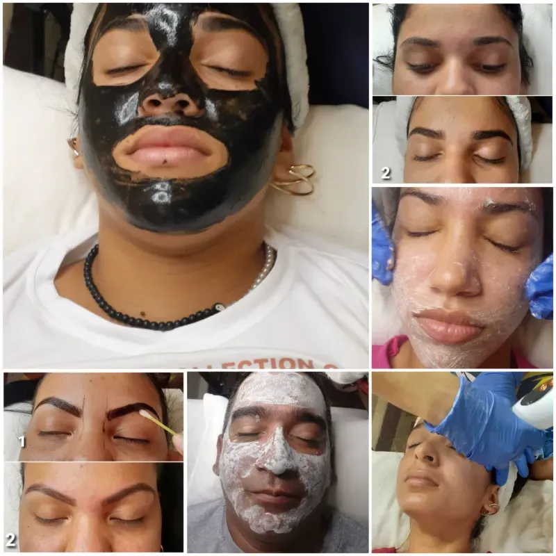 Limpieza facial profunda 