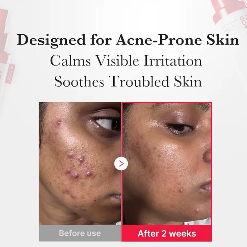 Medicube Hypochlorous Acid Daily Facial Spray ❤️