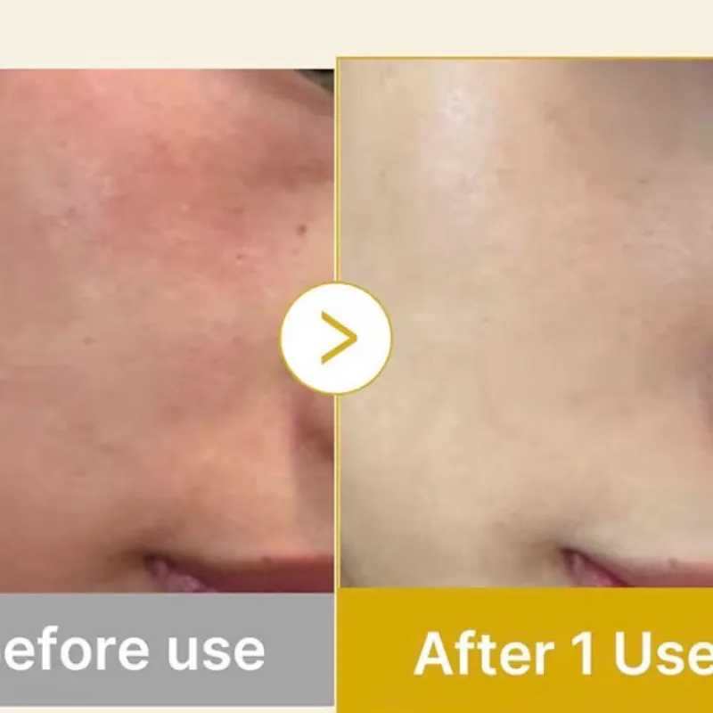 Medicube Kojic Acid Turmeric Vita Jelly Mist Serum ✨