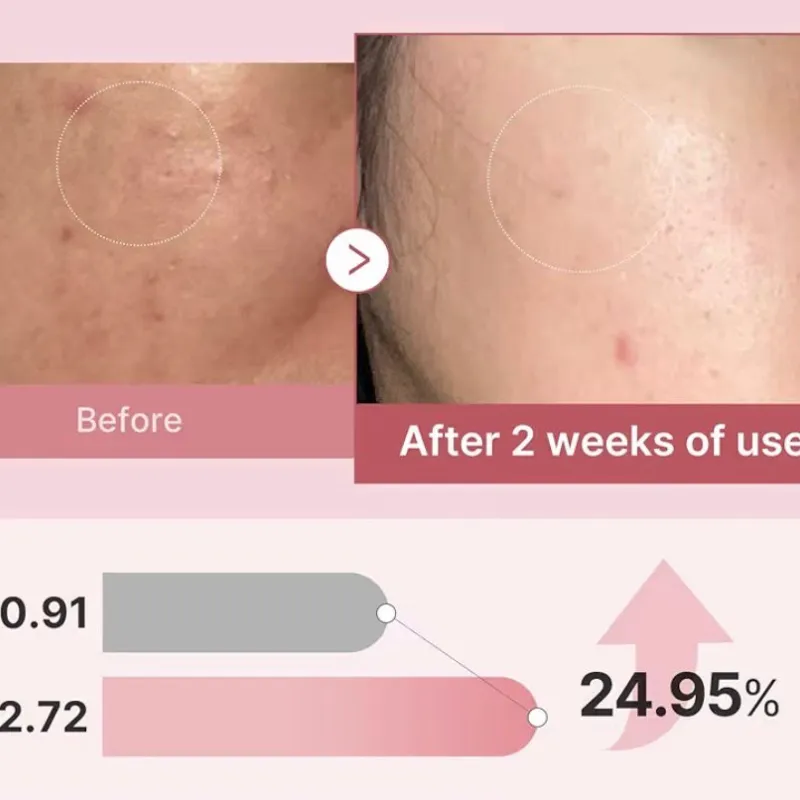 Medicube PDRN Pink Glutathione Serum Mist ✨🩷