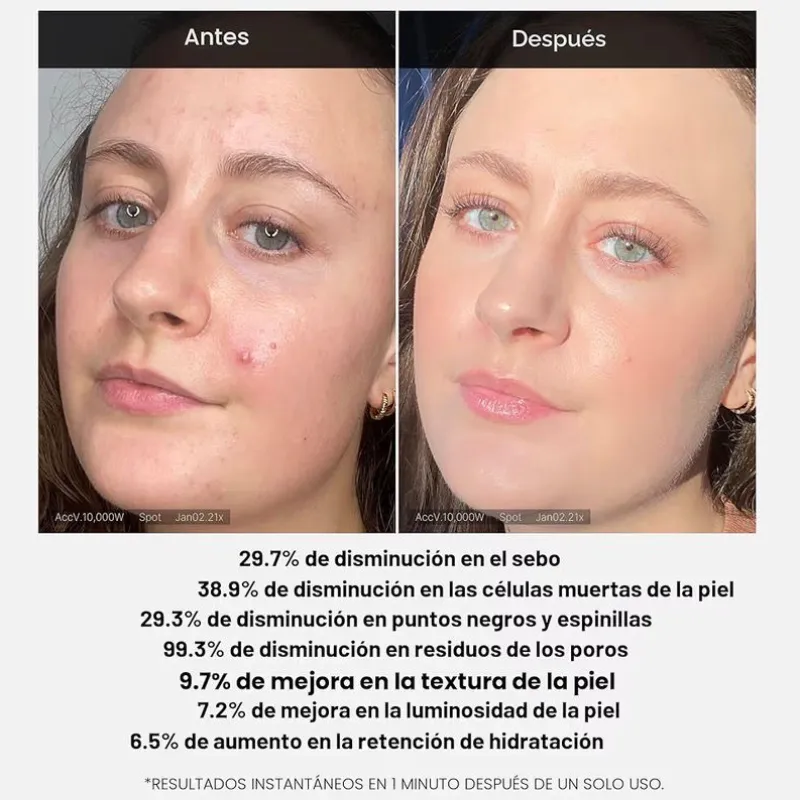 Medicube Red Succinic Acid Peel ❤️